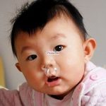 Cách trị nghẹt mũi cho trẻ em an toàn và hiệu quả